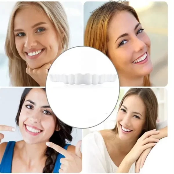 True Smile Veneers | Best Clip On teeth Veneers | Removable Veneers 1