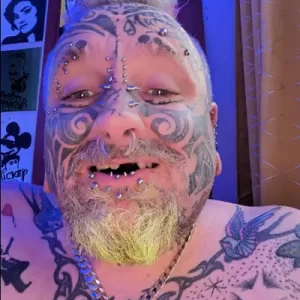 Cariad Gobaith (before) - Instant Smile Teeth Veneers