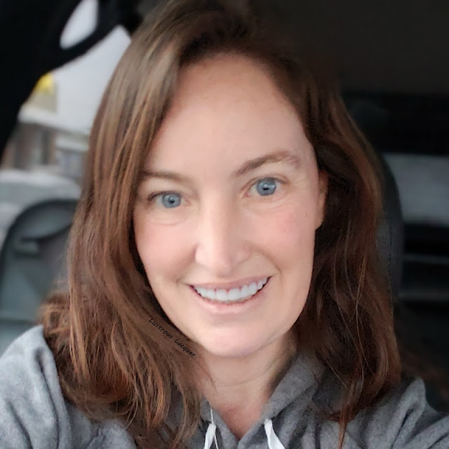 Instant Smile Veneers Customer After Image with Smile